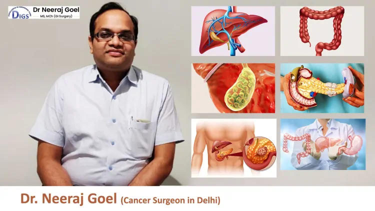 Unraveling Hope: Dr. Neeraj Goel, the Compassionate Cancer Surgeon in Delhi