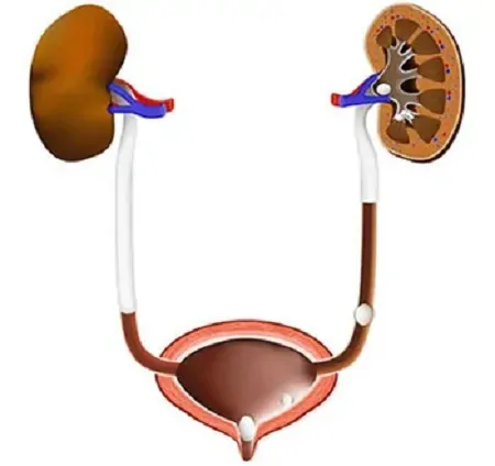 Vesicoureteric Reflux Treatment in India by Dr. Prashant Jain