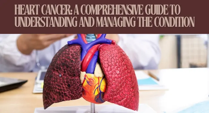 Heart Cancer: A Comprehensive Guide to Understanding and Managing the Condition