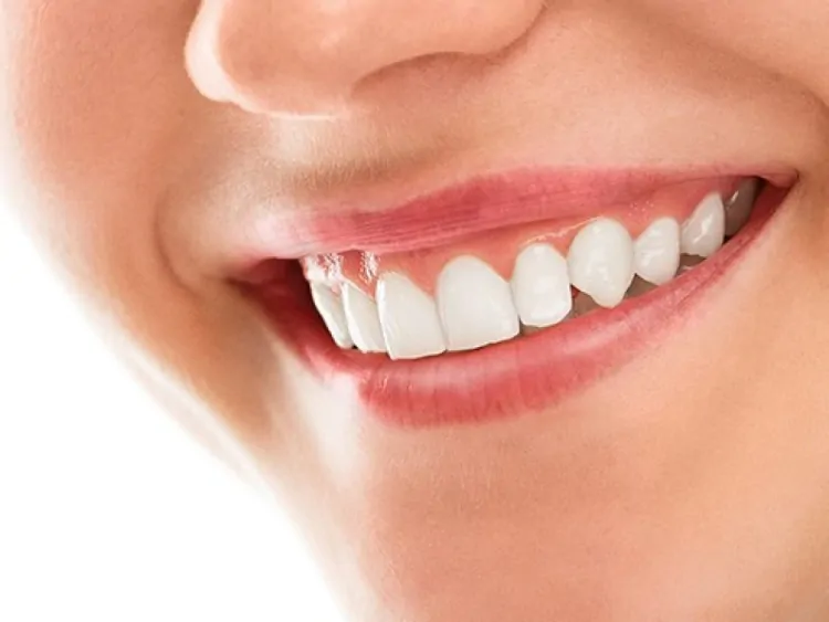 The Science Behind Professional Teeth Whitening: What to Expect