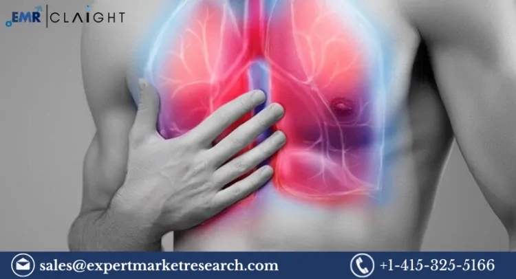 Acute Respiratory Syndrome Treatment Market Size, Share, Growth, Report 2032