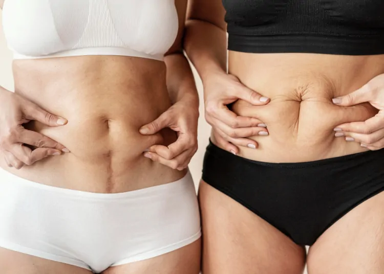 Transform Your Look with a Tummy Tuck in Raleigh, NC