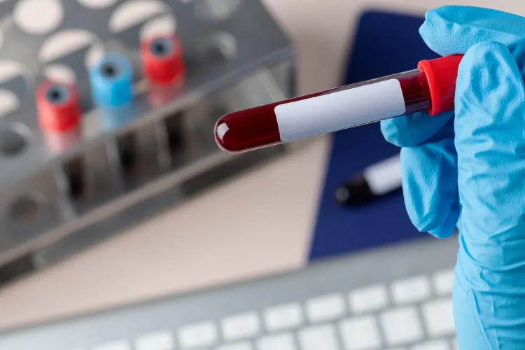 The Ultimate Guide to Preparing for a Blood Test Home Collection