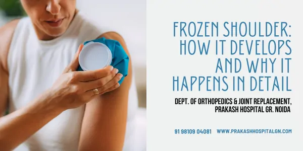 Frozen Shoulder: How It Develops and Why It Happens In Detail